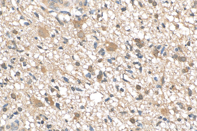 SHP2 Antibody in Immunohistochemistry (Paraffin) (IHC (P))