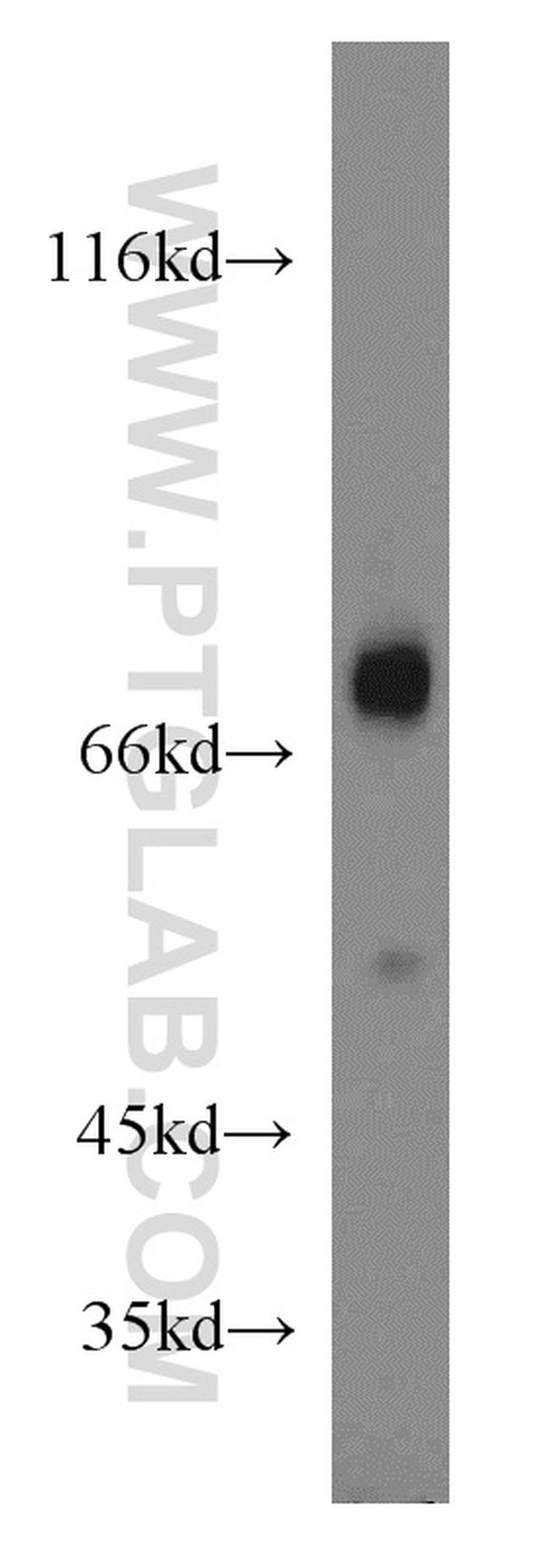 SHP2 Antibody in Western Blot (WB)