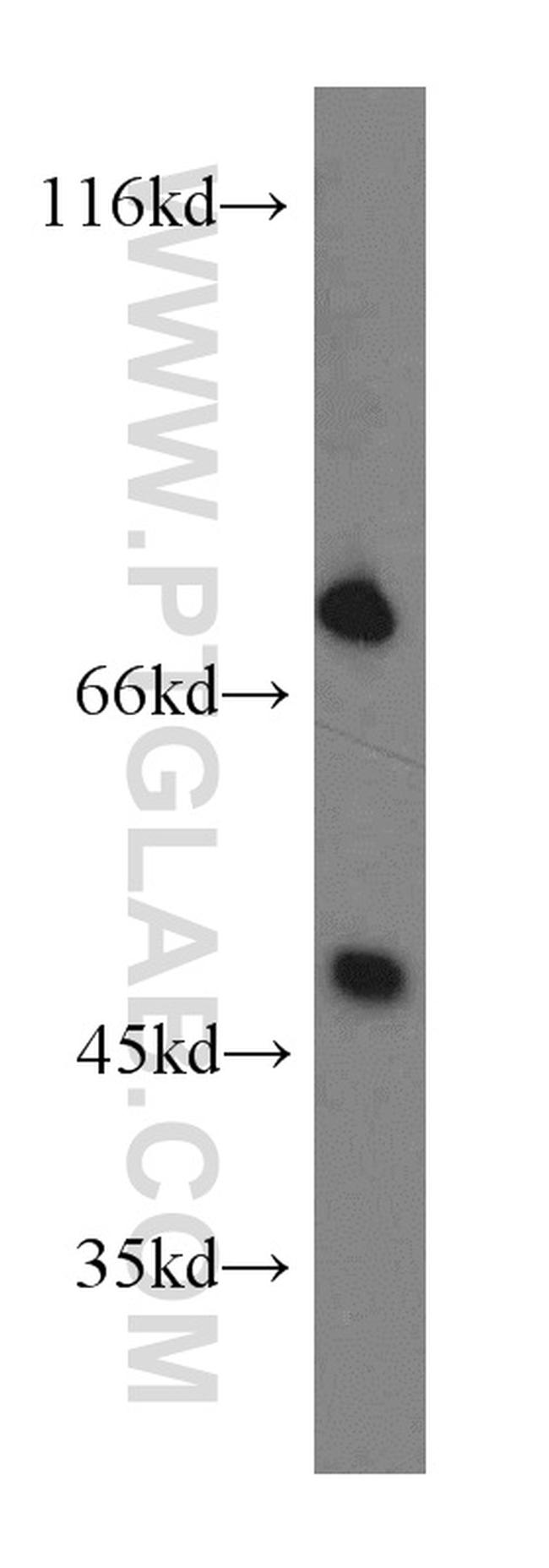 SHP2 Antibody in Western Blot (WB)