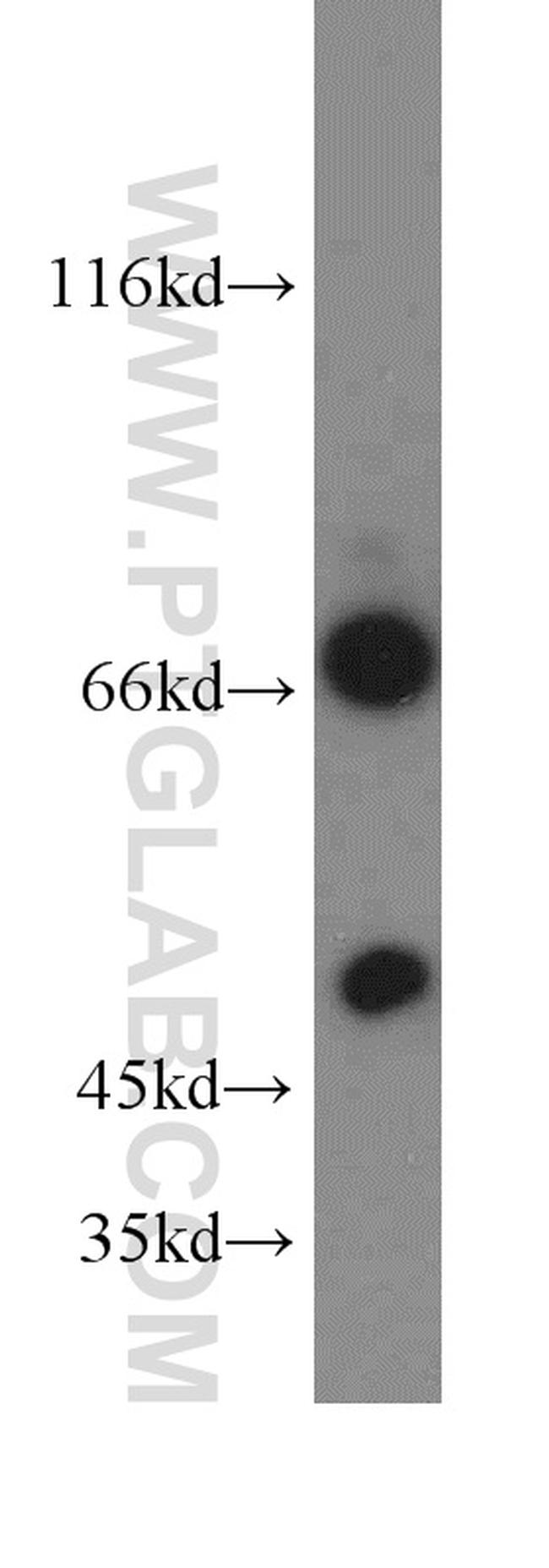 SHP2 Antibody in Western Blot (WB)