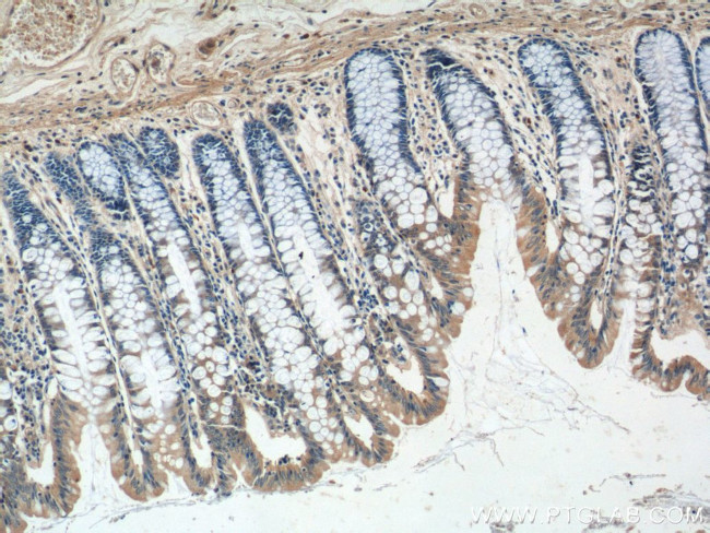 GPR81 Antibody in Immunohistochemistry (Paraffin) (IHC (P))