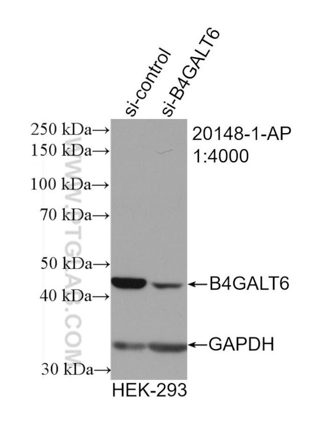 B4GALT6 Antibody in Western Blot (WB)