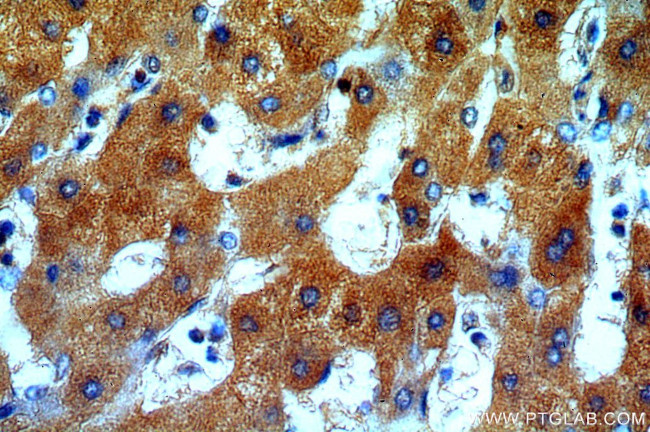 ERp19 Antibody in Immunohistochemistry (Paraffin) (IHC (P))