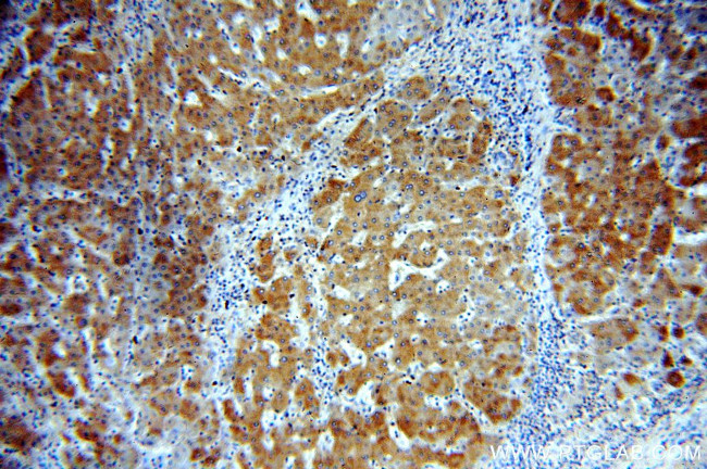 ERp19 Antibody in Immunohistochemistry (Paraffin) (IHC (P))