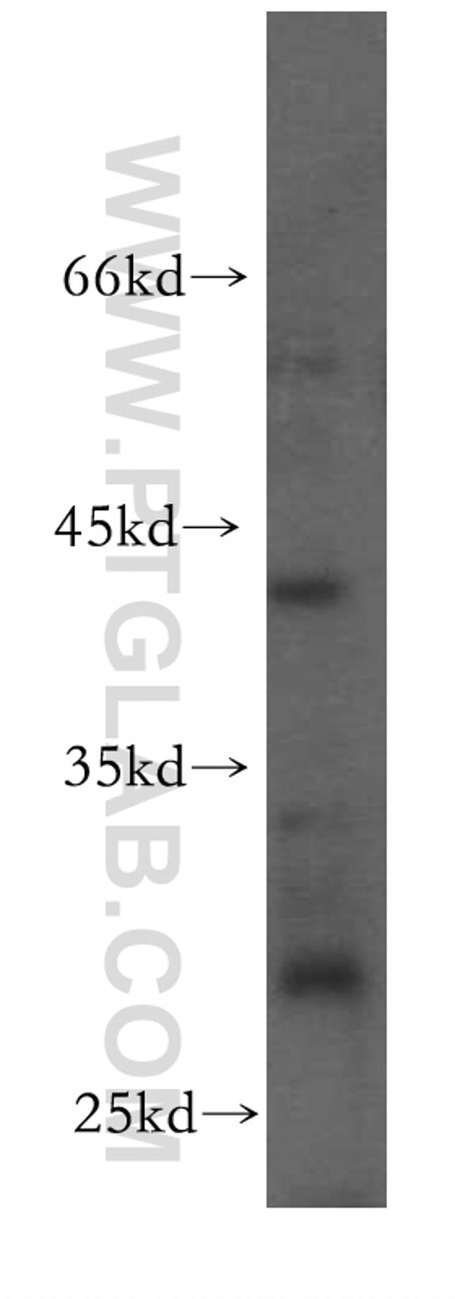 ERp19 Antibody in Western Blot (WB)