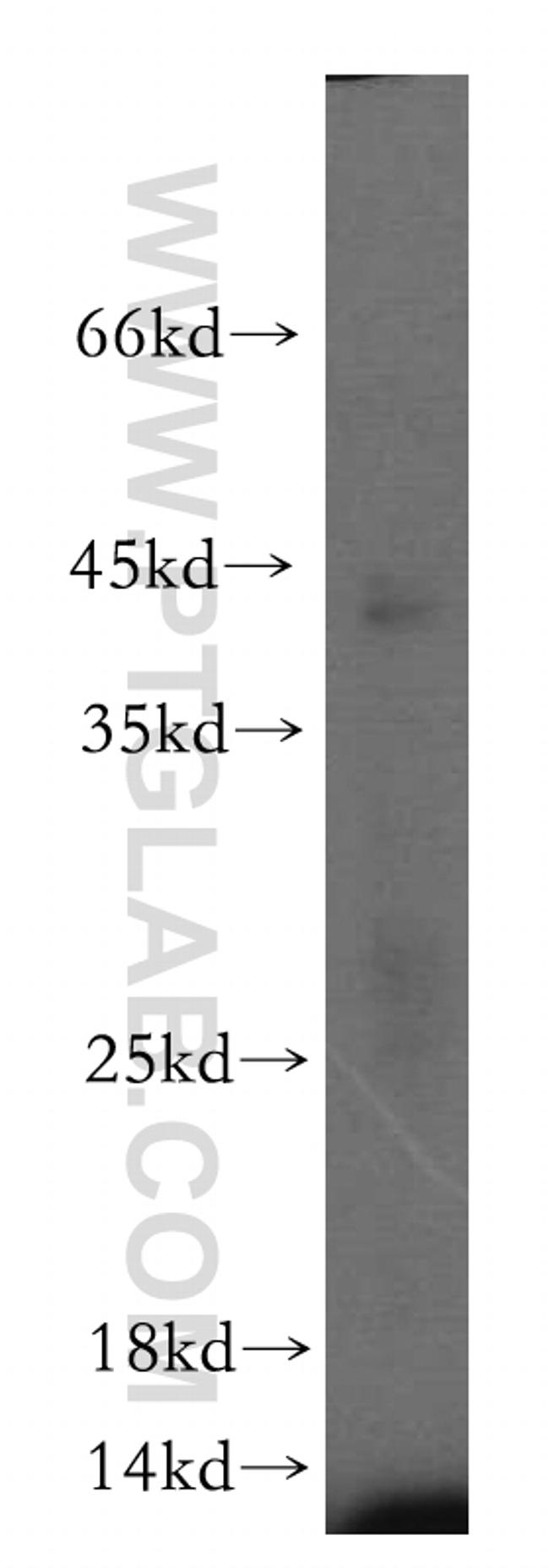 ERp19 Antibody in Western Blot (WB)