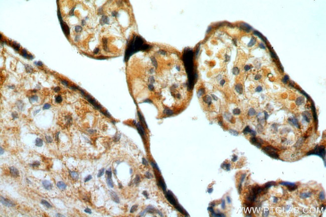 ERp19 Antibody in Immunohistochemistry (Paraffin) (IHC (P))