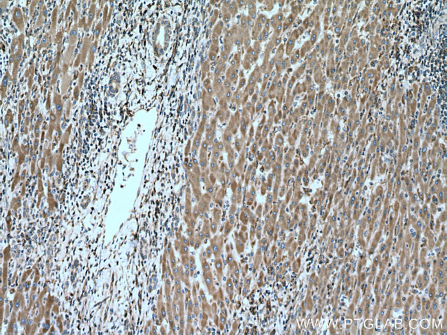 ERp19 Antibody in Immunohistochemistry (Paraffin) (IHC (P))