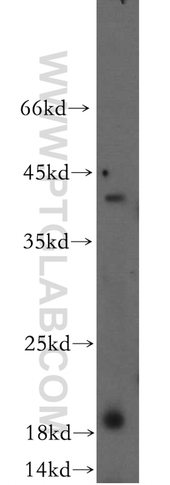 ERp19 Antibody in Western Blot (WB)