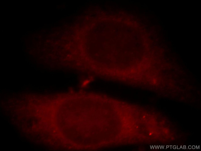 C11orf49 Antibody in Immunocytochemistry (ICC/IF)