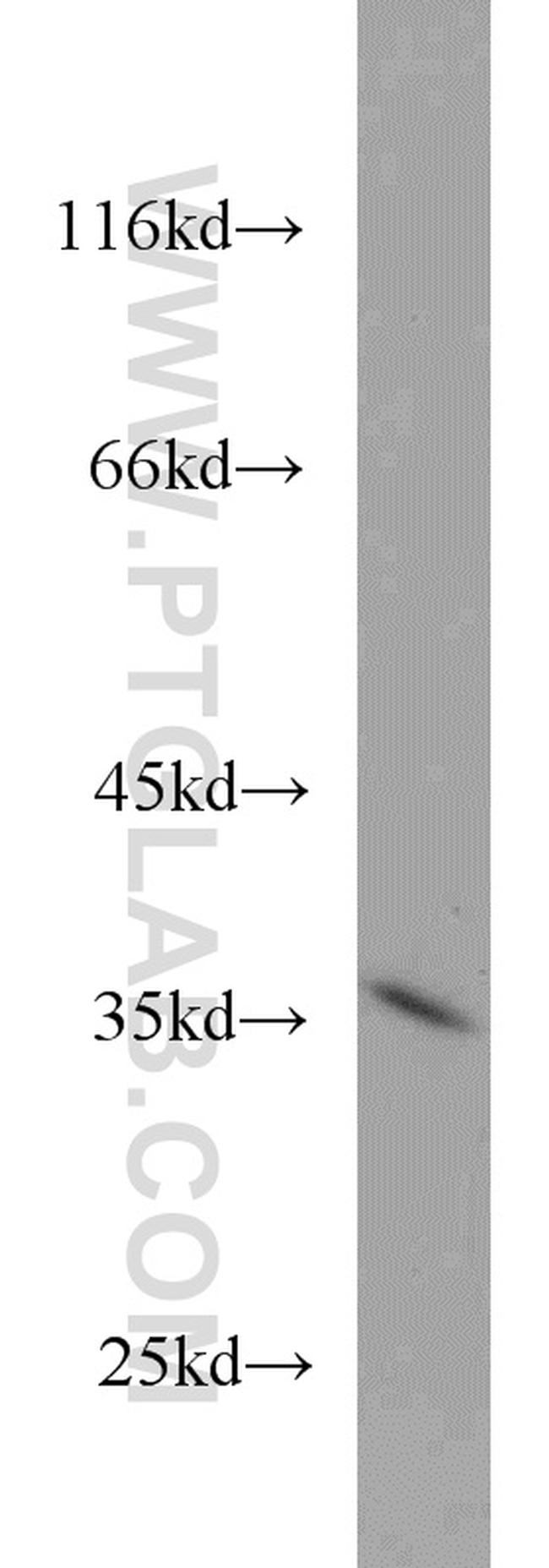 STEAP1 Antibody in Western Blot (WB)