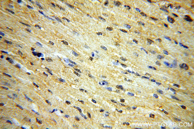 STEAP2 Antibody in Immunohistochemistry (Paraffin) (IHC (P))