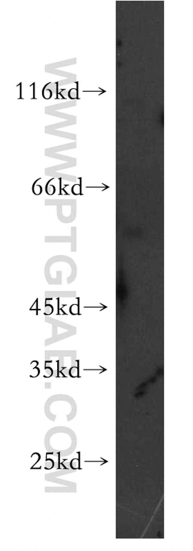 STEAP2 Antibody in Western Blot (WB)