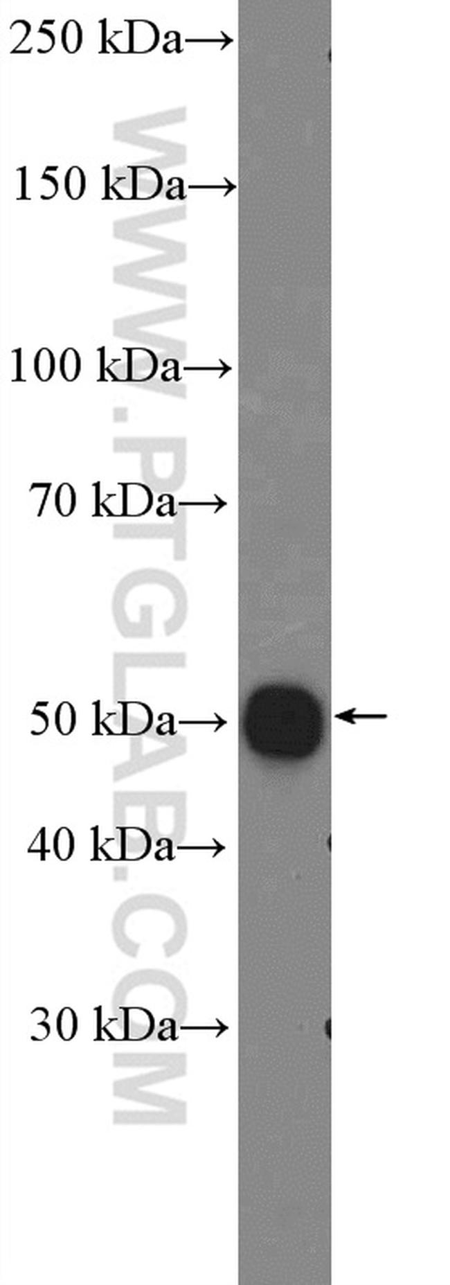 STEAP2 Antibody in Western Blot (WB)