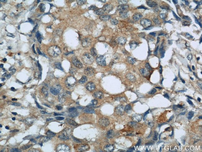 SLIT2 Antibody in Immunohistochemistry (Paraffin) (IHC (P))