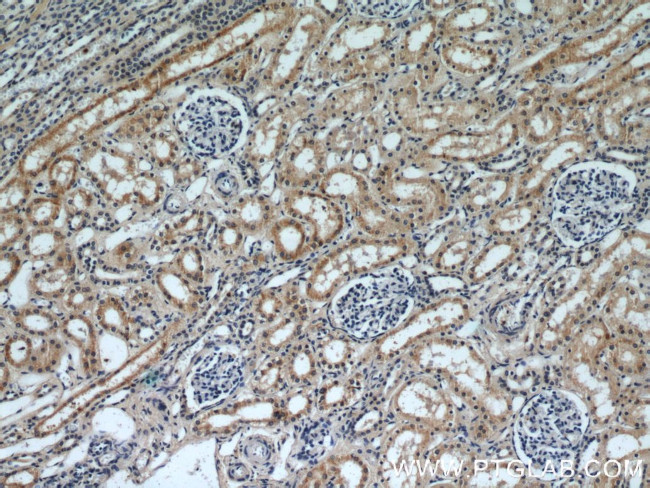 SLIT2 Antibody in Immunohistochemistry (Paraffin) (IHC (P))