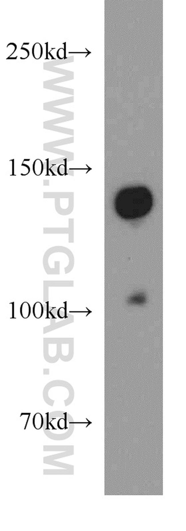 SLIT2 Antibody in Western Blot (WB)