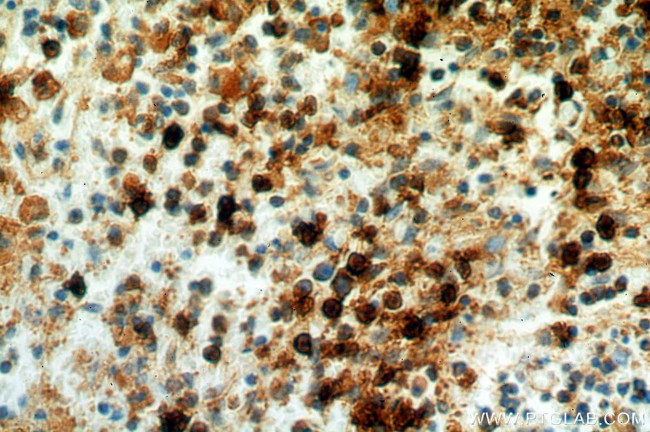 TOP2A Antibody in Immunohistochemistry (Paraffin) (IHC (P))