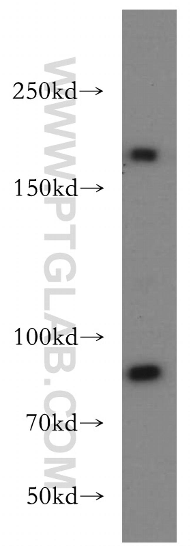 TOP2A Antibody in Western Blot (WB)