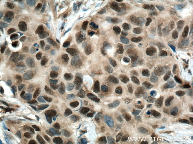 CSNK2B Antibody in Immunohistochemistry (Paraffin) (IHC (P))