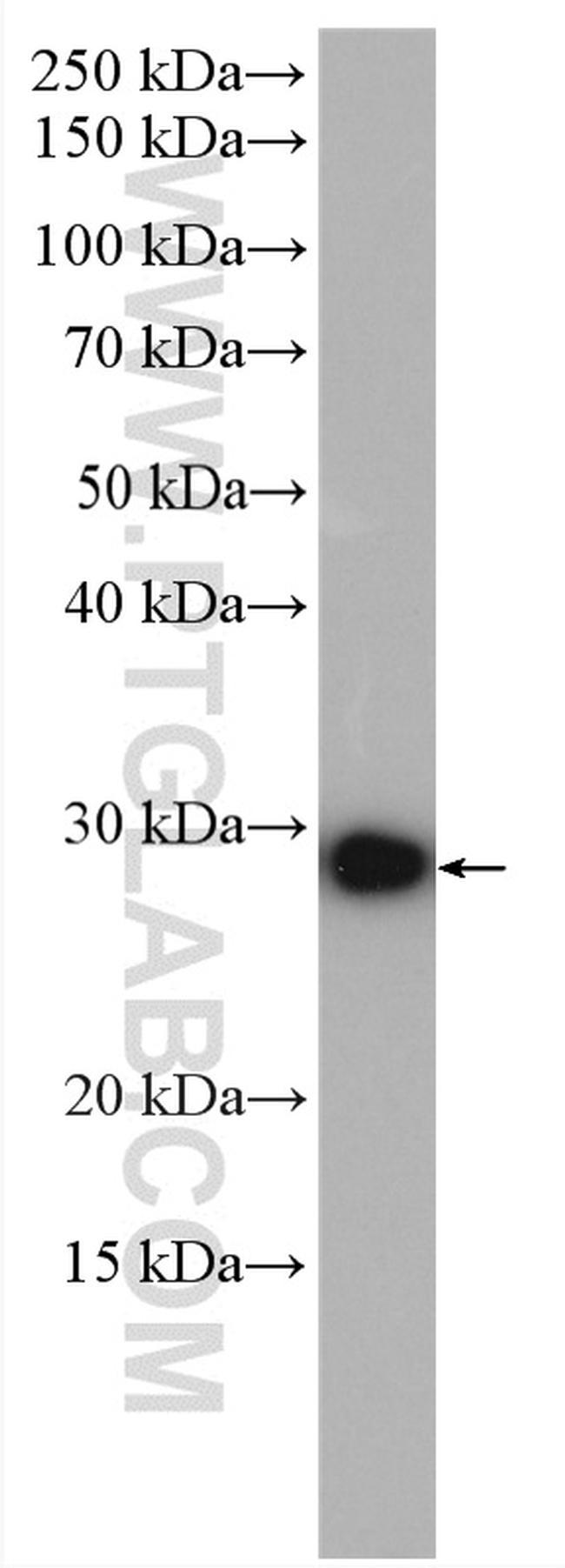 CSNK2B Antibody in Western Blot (WB)