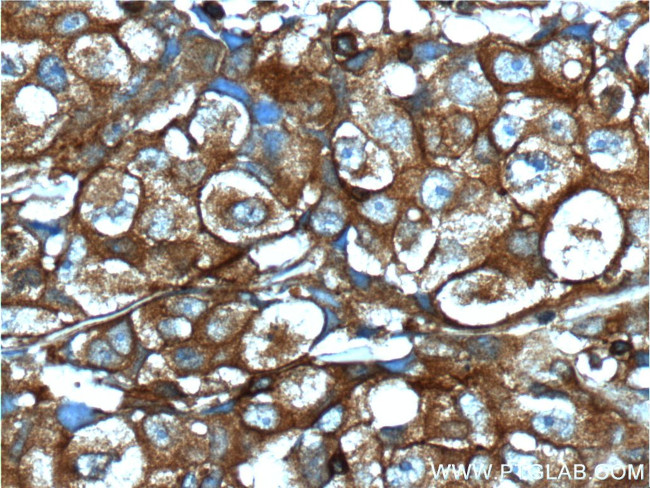 IGF1R beta chain Antibody in Immunohistochemistry (Paraffin) (IHC (P))