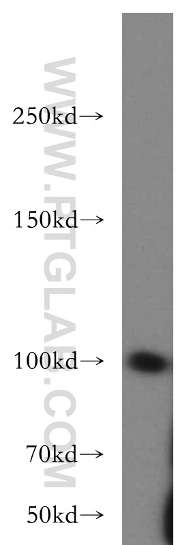 IGF1R beta chain Antibody in Western Blot (WB)