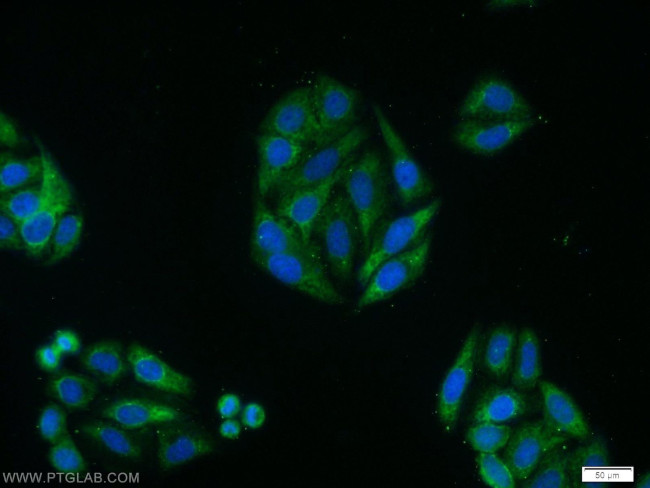 LATS2 Antibody in Immunocytochemistry (ICC/IF)