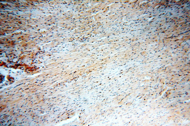 LATS2 Antibody in Immunohistochemistry (Paraffin) (IHC (P))