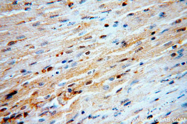 LATS2 Antibody in Immunohistochemistry (Paraffin) (IHC (P))