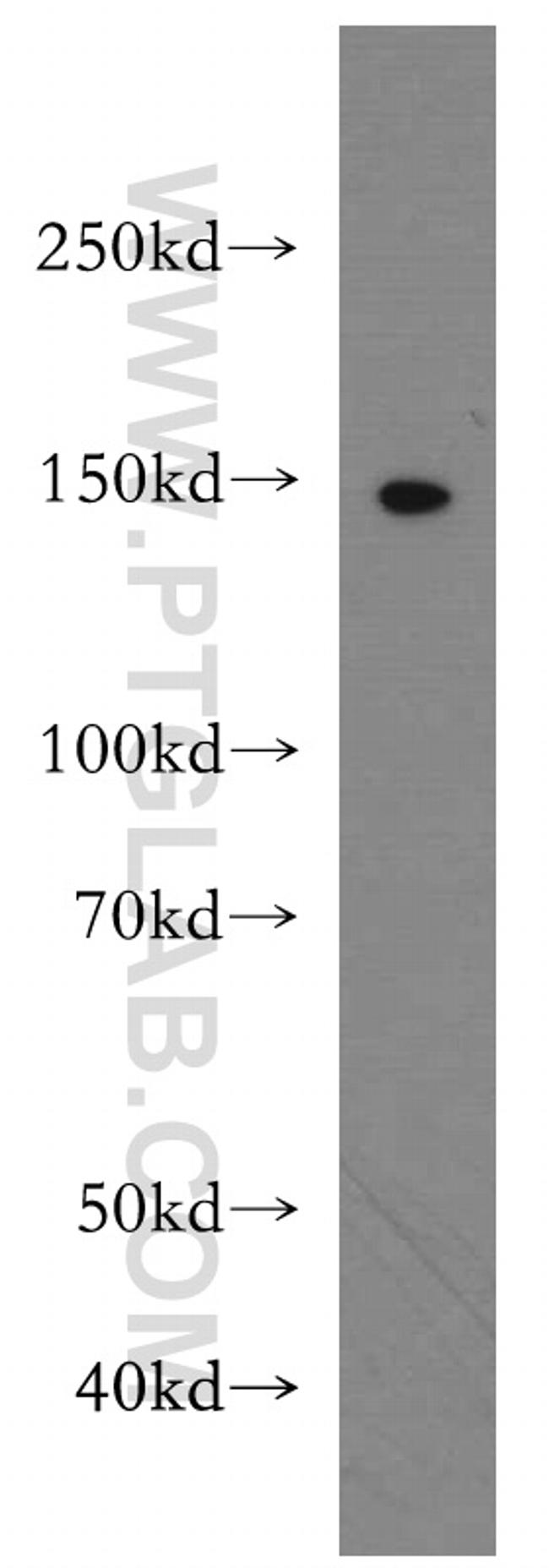 LATS2 Antibody in Western Blot (WB)