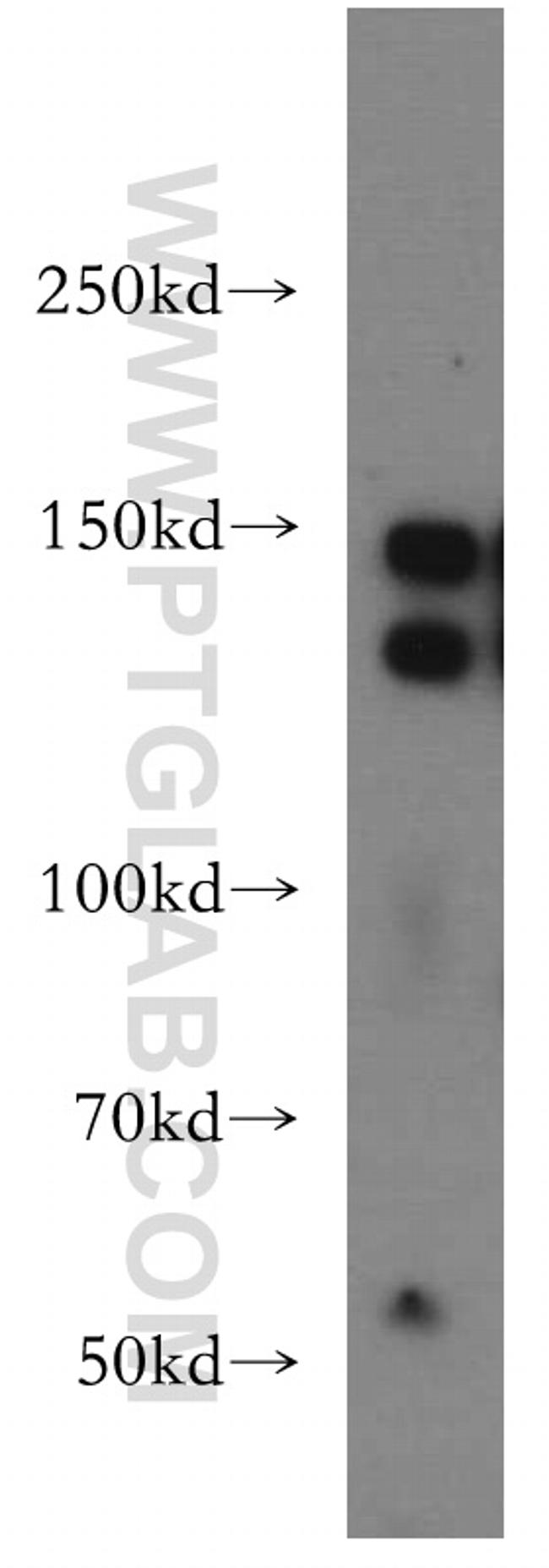 LATS2 Antibody in Western Blot (WB)