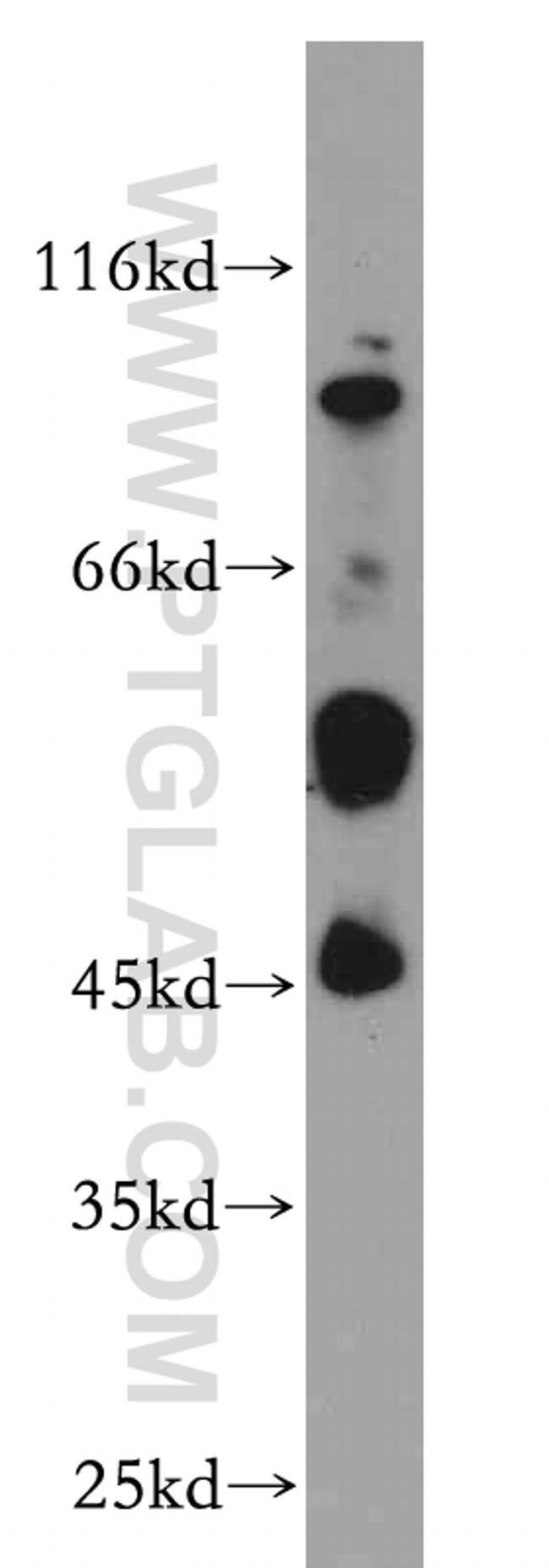 B4GALT2 Antibody in Western Blot (WB)