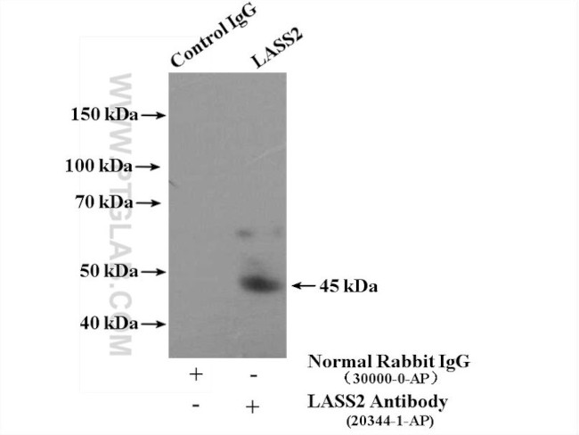 LASS2 Antibody in Immunoprecipitation (IP)