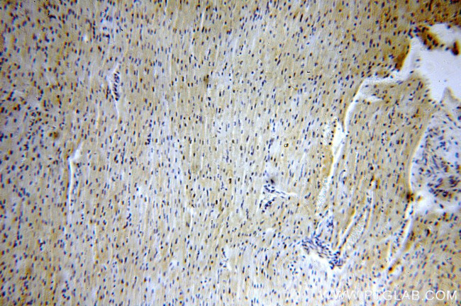 ZNF146 Antibody in Immunohistochemistry (Paraffin) (IHC (P))