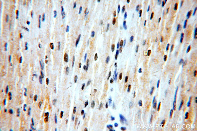 ZNF146 Antibody in Immunohistochemistry (Paraffin) (IHC (P))