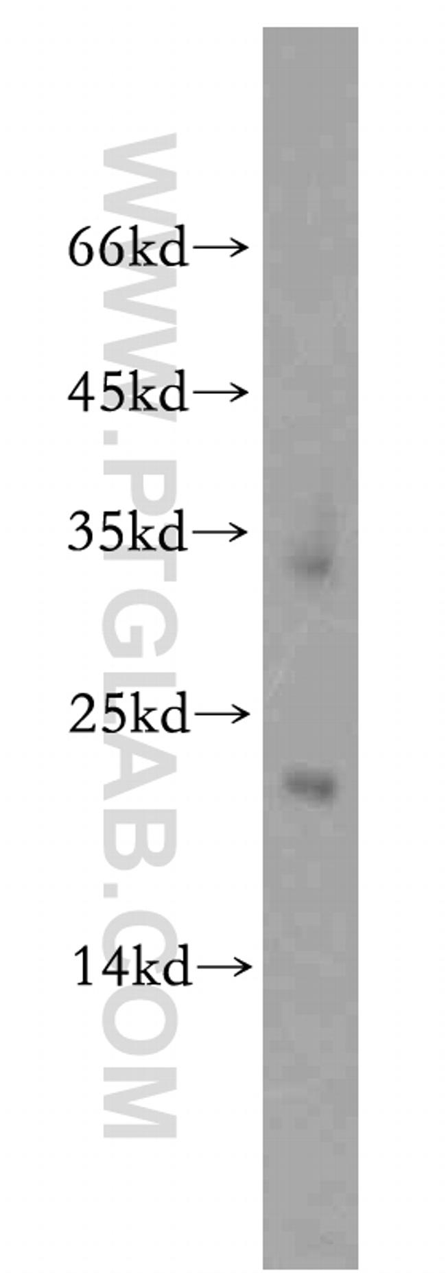 ZNF146 Antibody in Western Blot (WB)