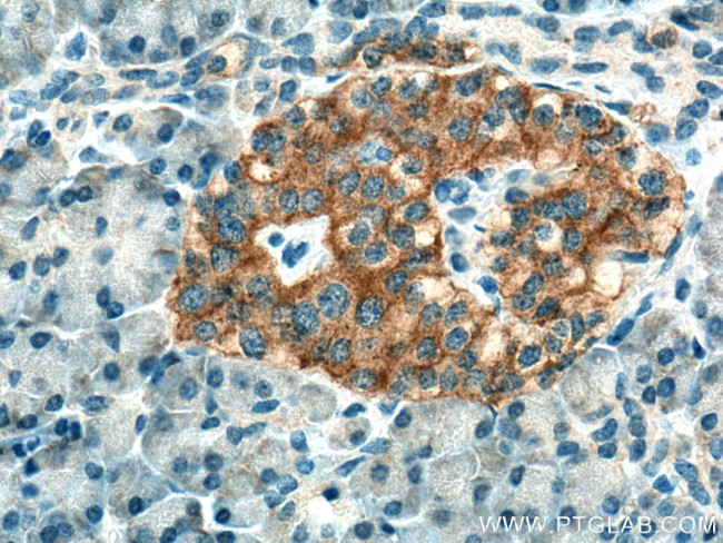 SSTR2 Antibody in Immunohistochemistry (Paraffin) (IHC (P))