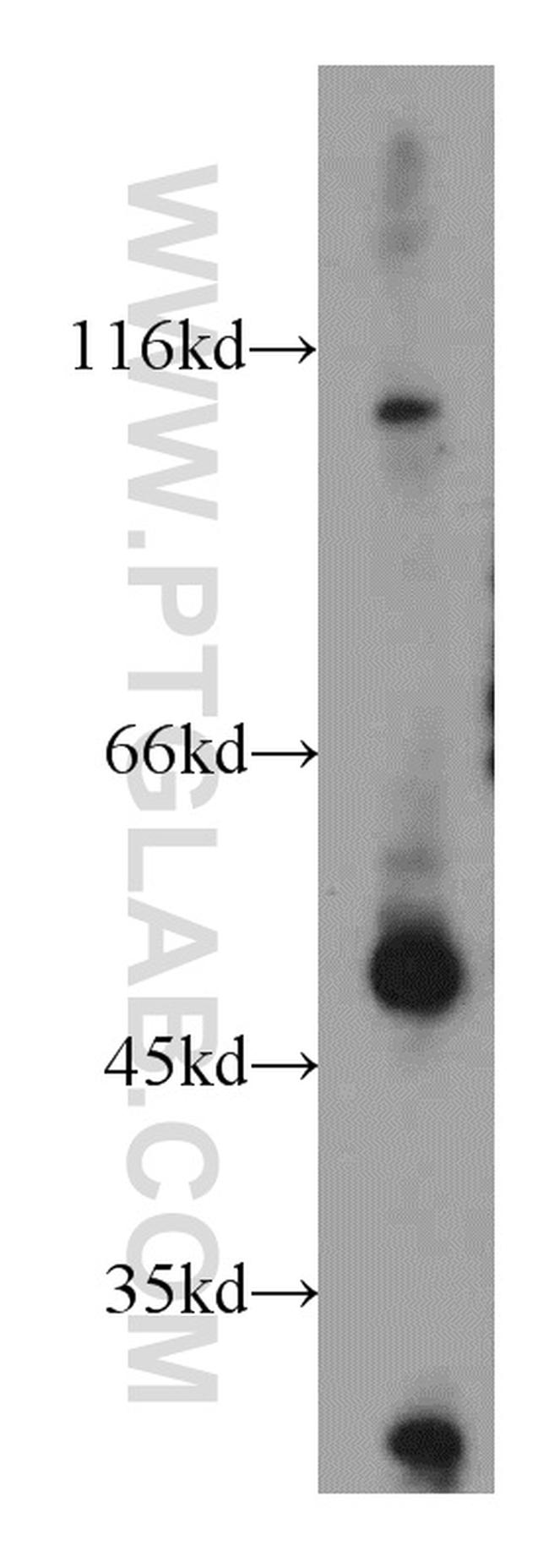 CXCR7 Antibody in Western Blot (WB)
