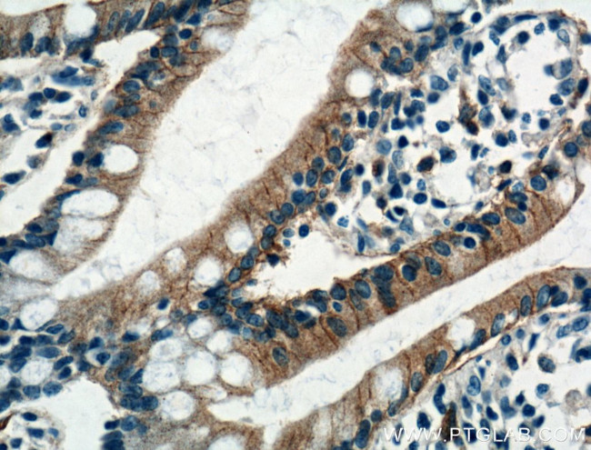 GLUT2 Antibody in Immunohistochemistry (Paraffin) (IHC (P))