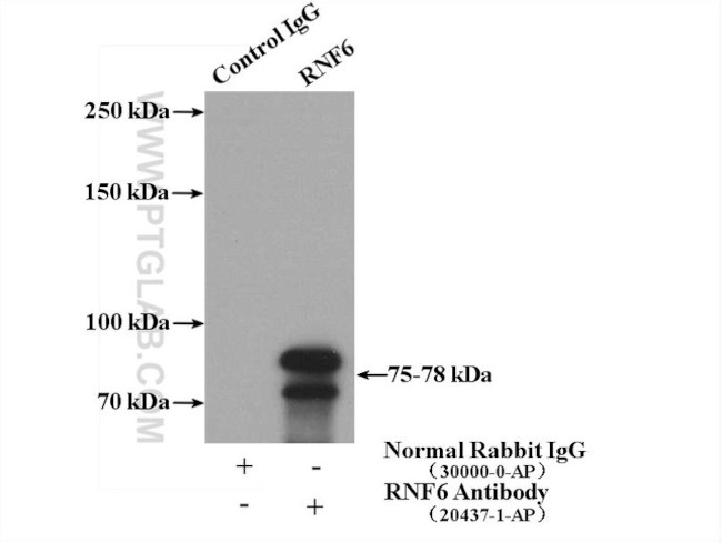 RNF6 Antibody in Immunoprecipitation (IP)
