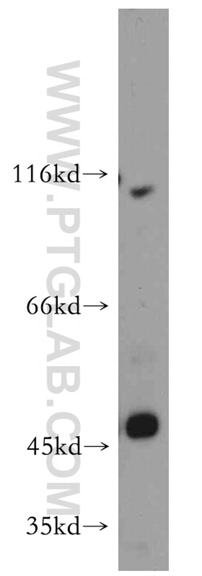 ZIP8 Antibody in Western Blot (WB)