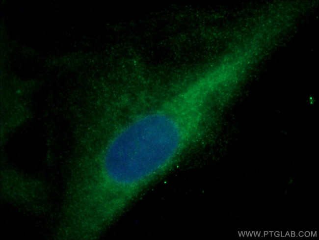 TBC1D17 Antibody in Immunocytochemistry (ICC/IF)