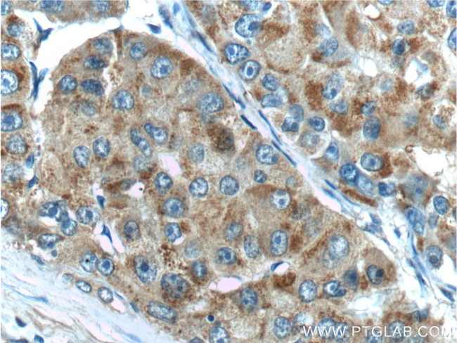 TBC1D17 Antibody in Immunohistochemistry (Paraffin) (IHC (P))