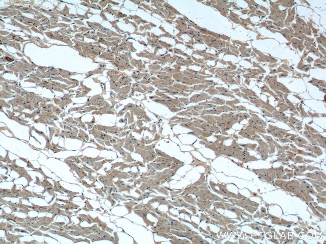 TBC1D17 Antibody in Immunohistochemistry (Paraffin) (IHC (P))