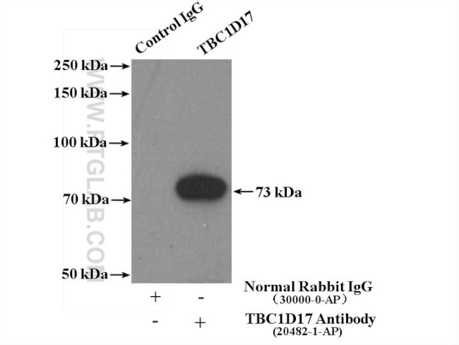 TBC1D17 Antibody in Immunoprecipitation (IP)