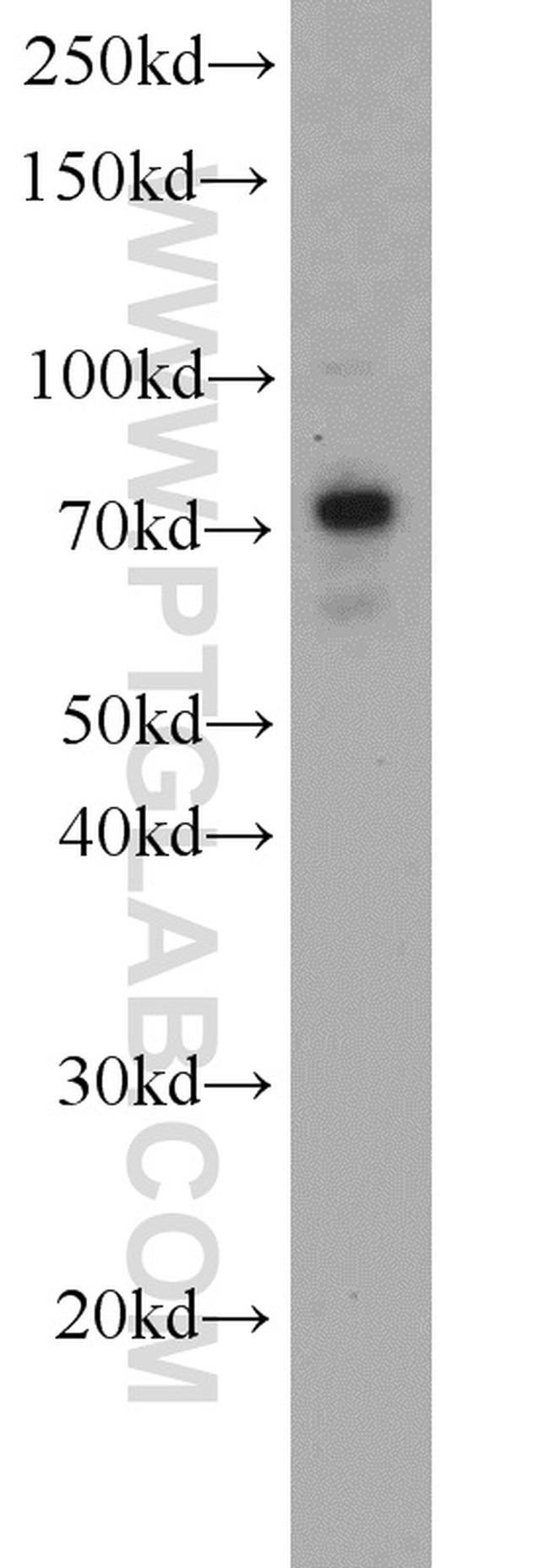 TBC1D17 Antibody in Western Blot (WB)