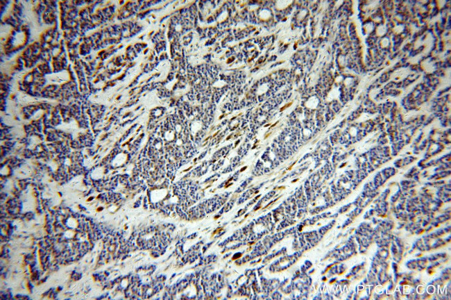 CEPT1 Antibody in Immunohistochemistry (Paraffin) (IHC (P))