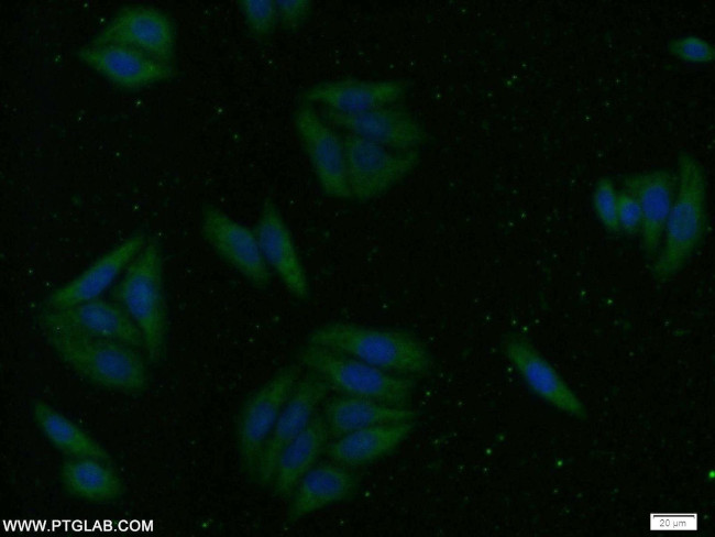 ZNF557 Antibody in Immunocytochemistry (ICC/IF)