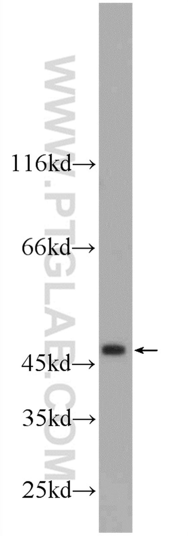 ZNF557 Antibody in Western Blot (WB)